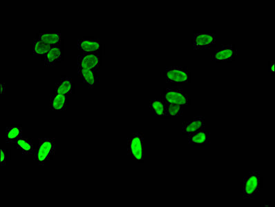 Immunofluorescent analysis of Hela cells using HIST1H3A (Ab-4) Antibody at dilution of 1:100 and Alexa Fluor 488-congugated AffiniPure Goat Anti-Rabbit IgG(H+L)Rabbit anti-Human HIST1H3A Polyclonal Antibody