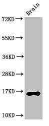 Western Blot  | Positive WB detected in: Mouse brain tissue  | All lanes: HIST1H3A antibody at 2.5µg/ml  | Secondary  | Goat polyclonal to rabbit IgG at 1/50000 dilution  | Predicted band size: 16 kDa  | Observed band size: 16 kDaRabbit anti-Human HIST1H3A Polyclonal Antibody