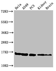 Western Blot  | Positive WB detected in: Hela cell acid extracts, A549 cell acid extracts, PC-3 cell acid extracts, Mouse kidney tissue, Mouse brain tissue  | All lanes: HIST1H3A antibody at 2µg/ml  | Secondary  | Goat polyclonal to rabbit IgG at 1/50000 dilution  | Predicted band size: 16 kDa  | Observed band size: 16 kDaRabbit anti-Human HIST1H3A Polyclonal Antibody