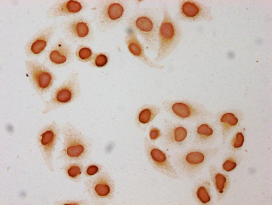 Immunocytochemistry analysis of Butyrly-HIST1H3A (K9) Antibody diluted at 1:50 and staining in Hela cells (treated with 30mM sodium butyrate for 4h) performed on a Leica BondTM system. The cells were fixed in 4% formaldehyde, permeabilized using 0.2% Triton X-100 and blocked with 10% normal goat serum 30min at RT. Then primary antibody (1% BSA) was incubated at 4°C overnight. The primary is detected by a biotinylated secondary antibody and visualized using an HRP conjugated SP system.Rabbit anti-Human HIST1H3A Polyclonal Antibody