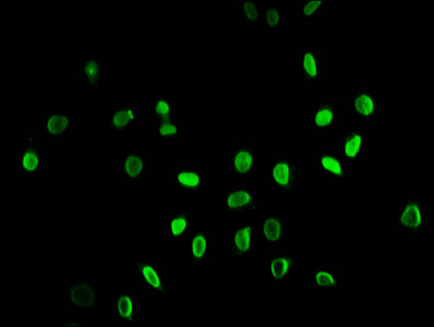 Immunofluorescence staining of Hela cells (treated with 30mM sodium butyrate for 4h) with Butyrly-HIST1H3A (K9) Antibody at 1:25, counter-stained with DAPI. The cells were fixed in 4% formaldehyde, permeabilized using 0.2% Triton X-100 and blocked in 10% normal Goat Serum. The cells were then incubated with the antibody overnight at 4°C. The secondary antibody was Alexa Fluor 488-congugated AffiniPure Goat Anti-Rabbit IgG(H+L).Rabbit anti-Human HIST1H3A Polyclonal Antibody