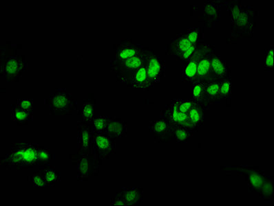 Immunofluorescence staining of MCF-7 cells with HIST1H3A (Ab-9) Antibody at 1:1, counter-stained with DAPI. The cells were fixed in 4% formaldehyde, permeabilized using 0.2% Triton X-100 and blocked in 10% normal Goat Serum. The cells were then incubated with the antibody overnight at 4°C. The secondary antibody was Alexa Fluor 488-congugated AffiniPure Goat Anti-Rabbit IgG(H+L).Rabbit anti-Human HIST1H3A Polyclonal Antibody