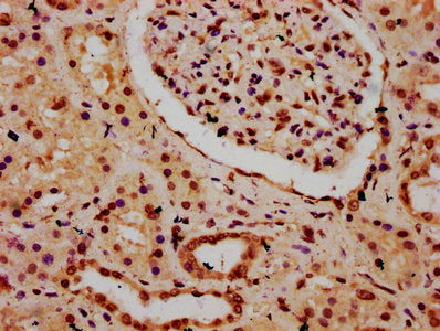 IHC image of HIST1H3A (Ab-9) Antibody diluted at 1:20 and staining in paraffin-embedded human kidney tissue performed on a Leica BondTM system. After dewaxing and hydration, antigen retrieval was mediated by high pressure in a citrate buffer (pH 6.0). Section was blocked with 10% normal goat serum 30min at RT. Then primary antibody (1% BSA) was incubated at 4°C overnight. The primary is detected by a biotinylated secondary antibody and visualized using an HRP conjugated SP system.Rabbit anti-Human HIST1H3A Polyclonal Antibody