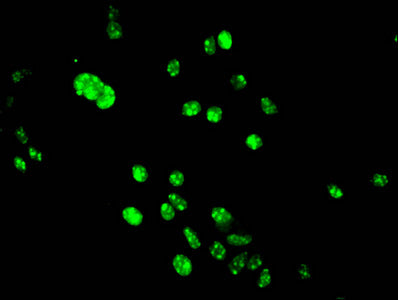 Immunofluorescent analysis of Hela cells using HIST1H3A (Ab-9) Antibody at dilution of 1:100 and Alexa Fluor 488-congugated AffiniPure Goat Anti-Rabbit IgG(H+L)Rabbit anti-Human HIST1H3A Polyclonal Antibody
