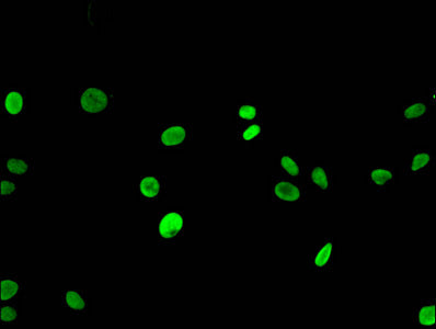 Immunofluorescent analysis of Hela cells using HIST1H3A (Ab-9) Antibody at dilution of 1:100 and Alexa Fluor 488-congugated AffiniPure Goat Anti-Rabbit IgG(H+L)Rabbit anti-Human HIST1H3A Polyclonal Antibody