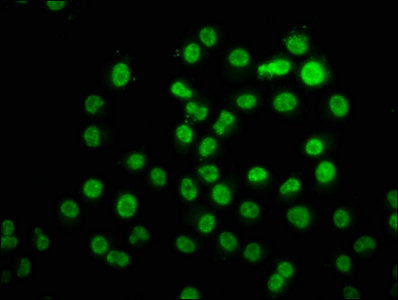 Immunofluorescence staining of Hela cells with HIST1H3A (Ab-11) Antibody at 1:1.3, counter-stained with DAPI. The cells were fixed in 4% formaldehyde, permeabilized using 0.2% Triton X-100 and blocked in 10% normal Goat Serum. The cells were then incubated with the antibody overnight at 4°C. The secondary antibody was Alexa Fluor 488-congugated AffiniPure Goat Anti-Rabbit IgG(H+L).Rabbit anti-Human HIST1H3A Polyclonal Antibody