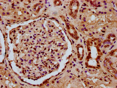 IHC image of HIST1H3A (Ab-11) Antibody diluted at 1:10 and staining in paraffin-embedded human kidney tissue performed on a Leica BondTM system. After dewaxing and hydration, antigen retrieval was mediated by high pressure in a citrate buffer (pH 6.0). Section was blocked with 10% normal goat serum 30min at RT. Then primary antibody (1% BSA) was incubated at 4°C overnight. The primary is detected by a biotinylated secondary antibody and visualized using an HRP conjugated SP system.Rabbit anti-Human HIST1H3A Polyclonal Antibody