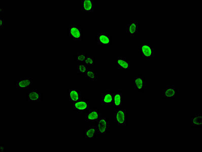 Immunofluorescent analysis of Hela cells using HIST1H3A (Ab-14) Antibody at dilution of 1:100 and Alexa Fluor 488-congugated AffiniPure Goat Anti-Rabbit IgG(H+L)Rabbit anti-Human HIST1H3A Polyclonal Antibody