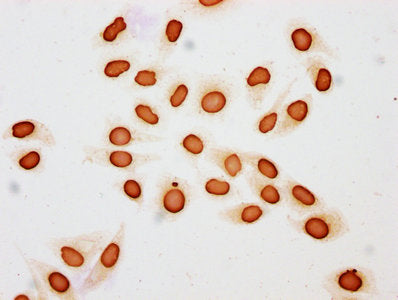 Immunocytochemistry analysis of Butyrly-HIST1H3A (K18) Antibody diluted at 1:200 and staining in Hela cells (treated with 30mM sodium butyrate for 4h) performed on a Leica BondTM system. The cells were fixed in 4% formaldehyde, permeabilized using 0.2% Triton X-100 and blocked with 10% normal goat serum 30min at RT. Then primary antibody (1% BSA) was incubated at 4°C overnight. The primary is detected by a biotinylated secondary antibody and visualized using an HRP conjugated SP system.Rabbit anti-Human HIST1H3A Polyclonal Antibody