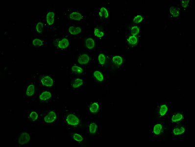 Immunofluorescence staining of Hela cells (treated with 30mM sodium butyrate for 4h) with Butyrly-HIST1H3A (K18) Antibody at 1:100, counter-stained with DAPI. The cells were fixed in 4% formaldehyde, permeabilized using 0.2% Triton X-100 and blocked in 10% normal Goat Serum. The cells were then incubated with the antibody overnight at 4°C. The secondary antibody was Alexa Fluor 488-congugated AffiniPure Goat Anti-Rabbit IgG(H+L).Rabbit anti-Human HIST1H3A Polyclonal Antibody