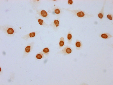 Immunocytochemistry analysis of 2-hydroxyisobutyryl-HIST1H3A (K18) Antibody diluted at 1:100 and staining in Hela cells (treated with 30mM sodium butyrate for 4h) performed on a Leica BondTM system. The cells were fixed in 4% formaldehyde, permeabilized using 0.2% Triton X-100 and blocked with 10% normal goat serum 30min at RT. Then primary antibody (1% BSA) was incubated at 4°C overnight. The primary is detected by a biotinylated secondary antibody and visualized using an HRP conjugated SP system.Rabbit anti-Human HIST1H3A Polyclonal Antibody