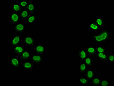 Immunofluorescence staining of Hela cells (treated with 30mM sodium butyrate for 4h) with 2-hydroxyisobutyryl-HIST1H3A (K18) Antibody at 1:50, counter-stained with DAPI. The cells were fixed in 4% formaldehyde, permeabilized using 0.2% Triton X-100 and blocked in 10% normal Goat Serum. The cells were then incubated with the antibody overnight at 4°C. The secondary antibody was Alexa Fluor 488-congugated AffiniPure Goat Anti-Rabbit IgG(H+L).Rabbit anti-Human HIST1H3A Polyclonal Antibody