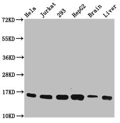 Western Blot  | Positive WB detected in: Hela whole cell lysate, Jurkat whole cell lysate, 293 whole cell lysate, HepG2 whole cell lysate, Rat brain tissue, Rat liver tissue  | All lanes: HIST1H3A antibody at 0.22µg/ml  | Secondary  | Goat polyclonal to rabbit IgG at 1/50000 dilution  | Predicted band size: 16 kDa  | Observed band size: 16 kDaRabbit anti-Human HIST1H3A Polyclonal Antibody
