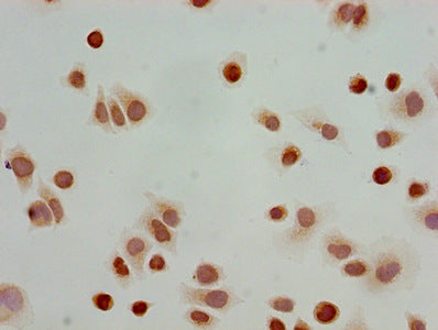 Immunocytochemistry analysis of Hela cells using Acetyl-HIST1H3A (K23) Antibody at dilution of 1:100Rabbit anti-Human HIST1H3A Polyclonal Antibody