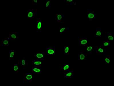 Immunofluorescent analysis of Hela cells treated with NaB using Acetyl-HIST1H3A (K23) Antibody at dilution of 1:100 and Alexa Fluor 488-congugated AffiniPure Goat Anti-Rabbit IgG(H+L)Rabbit anti-Human HIST1H3A Polyclonal Antibody