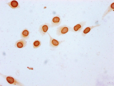 Immunocytochemistry analysis of Butyrly-HIST1H3A (K23) Antibody diluted at 1:20 and staining in Hela cells (treated with 30mM sodium butyrate for 4h) performed on a Leica BondTM system. The cells were fixed in 4% formaldehyde, permeabilized using 0.2% Triton X-100 and blocked with 10% normal goat serum 30min at RT. Then primary antibody (1% BSA) was incubated at 4°C overnight. The primary is detected by a biotinylated secondary antibody and visualized using an HRP conjugated SP system.Rabbit anti-Human HIST1H3A Polyclonal Antibody