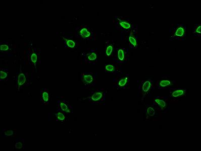 Immunofluorescence staining of Hela cells (treated with 30mM sodium butyrate for 4h) with Butyrly-HIST1H3A (K23) Antibody at 1:10, counter-stained with DAPI. The cells were fixed in 4% formaldehyde, permeabilized using 0.2% Triton X-100 and blocked in 10% normal Goat Serum. The cells were then incubated with the antibody overnight at 4°C. The secondary antibody was Alexa Fluor 488-congugated AffiniPure Goat Anti-Rabbit IgG(H+L).Rabbit anti-Human HIST1H3A Polyclonal Antibody