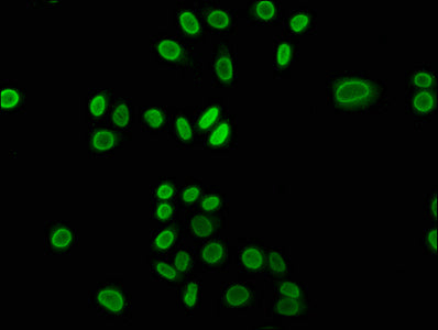 Immunofluorescence staining of Hela cells (treated with 30mM sodium butyrate for 4h) with 2-hydroxyisobutyryl-HIST1H3A (K23) Antibody at 1:15, counter-stained with DAPI. The cells were fixed in 4% formaldehyde, permeabilized using 0.2% Triton X-100 and blocked in 10% normal Goat Serum. The cells were then incubated with the antibody overnight at 4°C. The secondary antibody was Alexa Fluor 488-congugated AffiniPure Goat Anti-Rabbit IgG(H+L).Rabbit anti-Human HIST1H3A Polyclonal Antibody