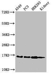 Western Blot  | Positive WB detected in: A549 cell acid extracts, PC-3 cell acid extracts, HEK293 cell acid extracts, Mouse kidney tissue  | All lanes: HIST1H3A antibody at 2µg/ml  | Secondary  | Goat polyclonal to rabbit IgG at 1/50000 dilution  | Predicted band size: 16 kDa  | Observed band size: 16 kDaRabbit anti-Human HIST1H3A Polyclonal Antibody