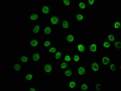 Immunofluorescence staining of A549 cells with HIST1H3A (Ab-23) Antibody at 1:10, counter-stained with DAPI. The cells were fixed in 4% formaldehyde, permeabilized using 0.2% Triton X-100 and blocked in 10% normal Goat Serum. The cells were then incubated with the antibody overnight at 4°C. The secondary antibody was Alexa Fluor 488-congugated AffiniPure Goat Anti-Rabbit IgG(H+L).Rabbit anti-Human HIST1H3A Polyclonal Antibody