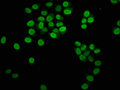 Immunofluorescence staining of Hela cells with HIST1H3A (Ab-23) Antibody at 1:20, counter-stained with DAPI. The cells were fixed in 4% formaldehyde, permeabilized using 0.2% Triton X-100 and blocked in 10% normal Goat Serum. The cells were then incubated with the antibody overnight at 4°C. The secondary antibody was Alexa Fluor 488-congugated AffiniPure Goat Anti-Rabbit IgG(H+L).Rabbit anti-Human HIST1H3A Polyclonal Antibody