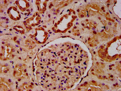 IHC image of HIST1H3A (Ab-23) Antibody diluted at 1:20 and staining in paraffin-embedded human kidney tissue performed on a Leica BondTM system. After dewaxing and hydration, antigen retrieval was mediated by high pressure in a citrate buffer (pH 6.0). Section was blocked with 10% normal goat serum 30min at RT. Then primary antibody (1% BSA) was incubated at 4°C overnight. The primary is detected by a biotinylated secondary antibody and visualized using an HRP conjugated SP system.Rabbit anti-Human HIST1H3A Polyclonal Antibody