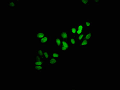 Immunofluorescence staining of HepG2 cells with HIST1H3A (Ab-23) Antibody at 1:25, counter-stained with DAPI. The cells were fixed in 4% formaldehyde, permeabilized using 0.2% Triton X-100 and blocked in 10% normal Goat Serum. The cells were then incubated with the antibody overnight at 4°C. The secondary antibody was Alexa Fluor 488-congugated AffiniPure Goat Anti-Rabbit IgG(H+L).Rabbit anti-Human HIST1H3A Polyclonal Antibody