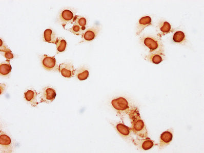 Immunocytochemistry analysis of Propionyl-HIST1H3A (K23) Antibody diluted at 1:50 and staining in Hela cells (treated with 10mM sodium propionate for 4h) performed on a Leica BondTM system. The cells were fixed in 4% formaldehyde, permeabilized using 0.2% Triton X-100 and blocked with 10% normal goat serum 30min at RT. Then primary antibody (1% BSA) was incubated at 4°C overnight. The primary is detected by a biotinylated secondary antibody and visualized using an HRP conjugated SP system.Rabbit anti-Human HIST1H3A Polyclonal Antibody