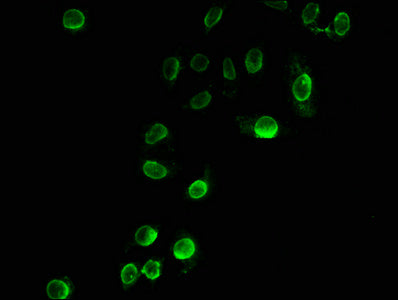 Immunofluorescence staining of A549 cells (treated with 10mM sodium propionate for 4h) with Propionyl-HIST1H3A (K23) Antibody at 1:25, counter-stained with DAPI. The cells were fixed in 4% formaldehyde, permeabilized using 0.2% Triton X-100 and blocked in 10% normal Goat Serum. The cells were then incubated with the antibody overnight at 4°C. The secondary antibody was Alexa Fluor 488-congugated AffiniPure Goat Anti-Rabbit IgG(H+L).Rabbit anti-Human HIST1H3A Polyclonal Antibody