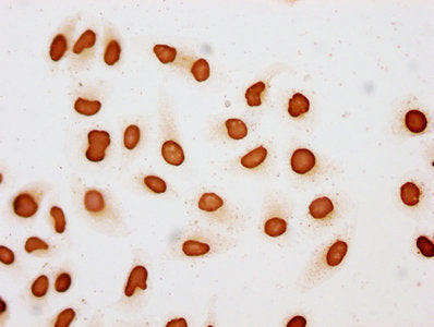 Immunocytochemistry analysis of Acetyl-HIST1H3A (K27) Antibody diluted at 1:10 and staining in Hela cells (treated with 30mM sodium butyrate for 4h) performed on a Leica BondTM system. The cells were fixed in 4% formaldehyde, permeabilized using 0.2% Triton X-100 and blocked with 10% normal goat serum 30min at RT. Then primary antibody (1% BSA) was incubated at 4°C overnight. The primary is detected by a biotinylated secondary antibody and visualized using an HRP conjugated SP system.Rabbit anti-Human HIST1H3A Polyclonal Antibody