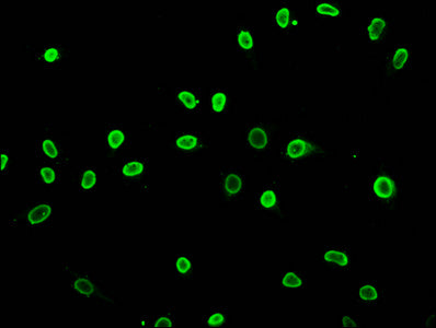Immunofluorescence staining of Hela cells (treated with 30mM sodium butyrate for 4h) with Acetyl-HIST1H3A (K27) Antibody at 1:5, counter-stained with DAPI. The cells were fixed in 4% formaldehyde, permeabilized using 0.2% Triton X-100 and blocked in 10% normal Goat Serum. The cells were then incubated with the antibody overnight at 4°C. The secondary antibody was Alexa Fluor 488-congugated AffiniPure Goat Anti-Rabbit IgG(H+L).Rabbit anti-Human HIST1H3A Polyclonal Antibody
