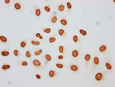 Immunocytochemistry analysis of Butyrly-HIST1H3A (K27) Antibody diluted at 1:30 and staining in Hela cells (treated with 30mM sodium butyrate for 4h) performed on a Leica BondTM system. The cells were fixed in 4% formaldehyde, permeabilized using 0.2% Triton X-100 and blocked with 10% normal goat serum 30min at RT. Then primary antibody (1% BSA) was incubated at 4°C overnight. The primary is detected by a biotinylated secondary antibody and visualized using an HRP conjugated SP system.Rabbit anti-Human HIST1H3A Polyclonal Antibody
