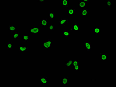 Immunofluorescence staining of Hela cells (treated with 30mM sodium butyrate for 4h) with Butyrly-HIST1H3A (K27) Antibody at 1:15, counter-stained with DAPI. The cells were fixed in 4% formaldehyde, permeabilized using 0.2% Triton X-100 and blocked in 10% normal Goat Serum. The cells were then incubated with the antibody overnight at 4°C. The secondary antibody was Alexa Fluor 488-congugated AffiniPure Goat Anti-Rabbit IgG(H+L).Rabbit anti-Human HIST1H3A Polyclonal Antibody