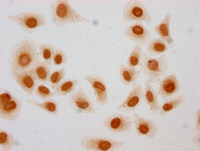 Immunocytochemistry analysis of 2-hydroxyisobutyryl-HIST1H3A (K27) Antibody diluted at 1:10 and staining in Hela cells (treated with 30mM sodium butyrate for 4h) performed on a Leica BondTM system. The cells were fixed in 4% formaldehyde, permeabilized using 0.2% Triton X-100 and blocked with 10% normal goat serum 30min at RT. Then primary antibody (1% BSA) was incubated at 4°C overnight. The primary is detected by a biotinylated secondary antibody and visualized using an HRP conjugated SP system.Rabbit anti-Human HIST1H3A Polyclonal Antibody