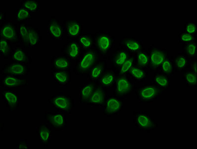 Immunofluorescence staining of Hela cells (treated with 30mM sodium butyrate for 4h) with 2-hydroxyisobutyryl-HIST1H3A (K27) Antibody at 1:5, counter-stained with DAPI. The cells were fixed in 4% formaldehyde, permeabilized using 0.2% Triton X-100 and blocked in 10% normal Goat Serum. The cells were then incubated with the antibody overnight at 4°C. The secondary antibody was Alexa Fluor 488-congugated AffiniPure Goat Anti-Rabbit IgG(H+L).Rabbit anti-Human HIST1H3A Polyclonal Antibody