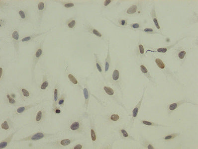 Immunocytochemistry analysis of Hela cells using Tri-methyl-HIST1H3A (K27) Antibody at dilution of 1:100Rabbit anti-Human HIST1H3A Polyclonal Antibody