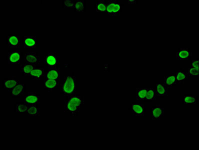 Immunofluorescent analysis of Hela cells using Tri-methyl-HIST1H3A (K27) Antibody at dilution of 1:100 and Alexa Fluor 488-congugated AffiniPure Goat Anti-Rabbit IgG(H+L)Rabbit anti-Human HIST1H3A Polyclonal Antibody