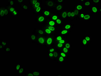 Immunofluorescence staining of HepG2 cells with HIST1H3A (Ab-27) Antibody at 1:7.5, counter-stained with DAPI. The cells were fixed in 4% formaldehyde, permeabilized using 0.2% Triton X-100 and blocked in 10% normal Goat Serum. The cells were then incubated with the antibody overnight at 4°C. The secondary antibody was Alexa Fluor 488-congugated AffiniPure Goat Anti-Rabbit IgG(H+L).Rabbit anti-Human HIST1H3A Polyclonal Antibody