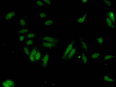 Immunofluorescent analysis of Hela cells using HIST1H3A (Ab-27) Antibody at dilution of 1:100 and Alexa Fluor 488-congugated AffiniPure Goat Anti-Rabbit IgG(H+L)Rabbit anti-Human HIST1H3A Polyclonal Antibody