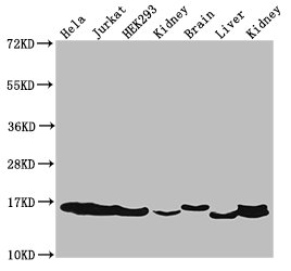Western Blot  | Positive WB detected in: Hela cell acid extracts, Jurkat cell acid extracts, HEK293 cell acid extracts, Rat kidney tissue, Mouse brain tissue, Mouse liver tissue, Mouse kidney tissue  | All lanes: HIST1H3A antibody at 2µg/ml  | Secondary  | Goat polyclonal to rabbit IgG at 1/50000 dilution  | Predicted band size: 16 kDa  | Observed band size: 16 kDaRabbit anti-Human HIST1H3A Polyclonal Antibody