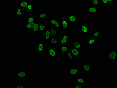 Immunofluorescence staining of Hela cells with Acetyl-HIST1H3A (K36) Antibody at 1:37.5, counter-stained with DAPI. The cells were fixed in 4% formaldehyde, permeabilized using 0.2% Triton X-100 and blocked in 10% normal Goat Serum. The cells were then incubated with the antibody overnight at 4°C. The secondary antibody was Alexa Fluor 488-congugated AffiniPure Goat Anti-Rabbit IgG(H+L).Rabbit anti-Human HIST1H3A Polyclonal Antibody