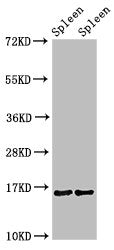 Western Blot  | Positive WB detected in: Mouse spleen tissue, Rat spleen tissue  | All lanes: HIST1H3A antibody at 1.4µg/ml  | Secondary  | Goat polyclonal to rabbit IgG at 1/50000 dilution  | Predicted band size: 16 kDa  | Observed band size: 16 kDaRabbit anti-Human HIST1H3A Polyclonal Antibody