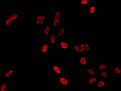 Immunofluorescent analysis of Hela cells using HIST1H3A (Ab-36) Antibody at dilution of 1:100 and Cy3-congugated Goat Anti-Rabbit IgGRabbit anti-Human HIST1H3A Polyclonal Antibody