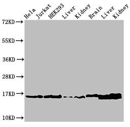 Western Blot  | Positive WB detected in: Hela cell acid extracts, Jurkat cell acid extracts, HEK293 cell acid extracts, Rat liver tissue, Rat kidney tissue, Mouse brain tissue, Mouse liver tissue, Mouse kidney tissue  | All lanes: HIST1H3A antibody at 1.5µg/ml  | Secondary  | Goat polyclonal to rabbit IgG at 1/50000 dilution  | Predicted band size: 16 kDa  | Observed band size: 16 kDaRabbit anti-Human HIST1H3A Polyclonal Antibody