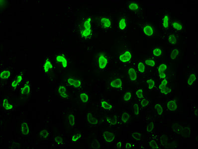 Immunofluorescence staining of Hela cells (treated with 30mM sodium butyrate for 4h) with Acetyl-HIST1H3A (K37) Antibody at 1:7.5, counter-stained with DAPI. The cells were fixed in 4% formaldehyde, permeabilized using 0.2% Triton X-100 and blocked in 10% normal Goat Serum. The cells were then incubated with the antibody overnight at 4°C. The secondary antibody was Alexa Fluor 488-congugated AffiniPure Goat Anti-Rabbit IgG(H+L).Rabbit anti-Human HIST1H3A Polyclonal Antibody