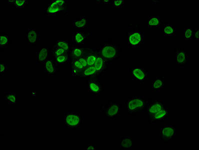 Immunofluorescence staining of MCF-7 cells with HIST1H3A (Ab-37) Antibody at 1:2.5, counter-stained with DAPI. The cells were fixed in 4% formaldehyde, permeabilized using 0.2% Triton X-100 and blocked in 10% normal Goat Serum. The cells were then incubated with the antibody overnight at 4°C. The secondary antibody was Alexa Fluor 488-congugated AffiniPure Goat Anti-Rabbit IgG(H+L).Rabbit anti-Human HIST1H3A Polyclonal Antibody