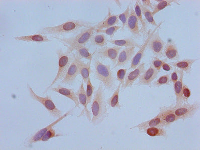 Immunocytochemistry analysis of Hela cells using Tri-methyl-HIST1H3A (K4) Antibody at dilution of 1:100Rabbit anti-Human HIST1H3A Polyclonal Antibody