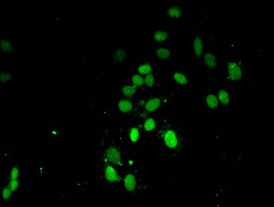 Immunofluorescent analysis of Hela cells using Tri-methyl-HIST1H3A (K4) Antibody at dilution of 1:100 and Alexa Fluor 488-congugated AffiniPure Goat Anti-Rabbit IgG(H+L)Rabbit anti-Human HIST1H3A Polyclonal Antibody