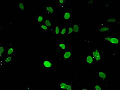 Immunofluorescent analysis of Hela cells using HIST1H3A (Ab-4) Antibody at dilution of 1:100 and Alexa Fluor 488-congugated AffiniPure Goat Anti-Rabbit IgG(H+L)Rabbit anti-Human HIST1H3A Polyclonal Antibody
