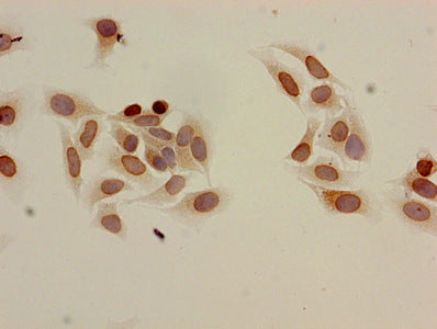 Immunocytochemistry analysis of Hela cells using Acetyl-HIST1H3A (K9) Antibody at dilution of 1:100Rabbit anti-Human HIST1H3A Polyclonal Antibody
